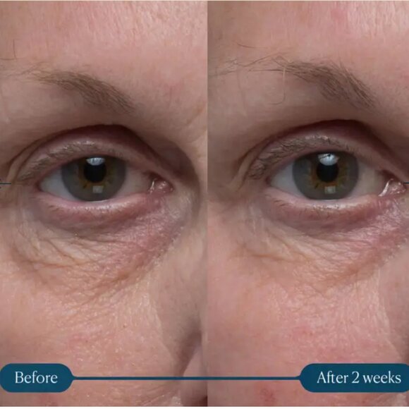 ELEMIS Pro-Collagen Vitality Eye Cream NIB Factory Sealed! - Picture 4 of 12